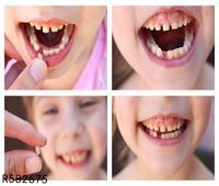 晚上磨牙是什么原因引起 晚上磨牙暗示身体有这些问题