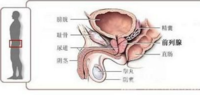 怎么按摩前列腺 前列腺按摩需要注意什么