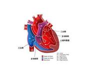新生儿室间隔缺损什么原因 新生儿室间隔缺损怎么办