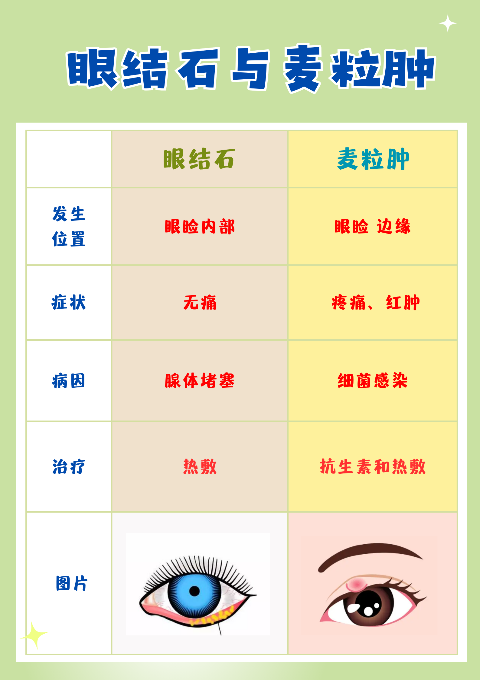 眼睑结石会自行消失吗图片