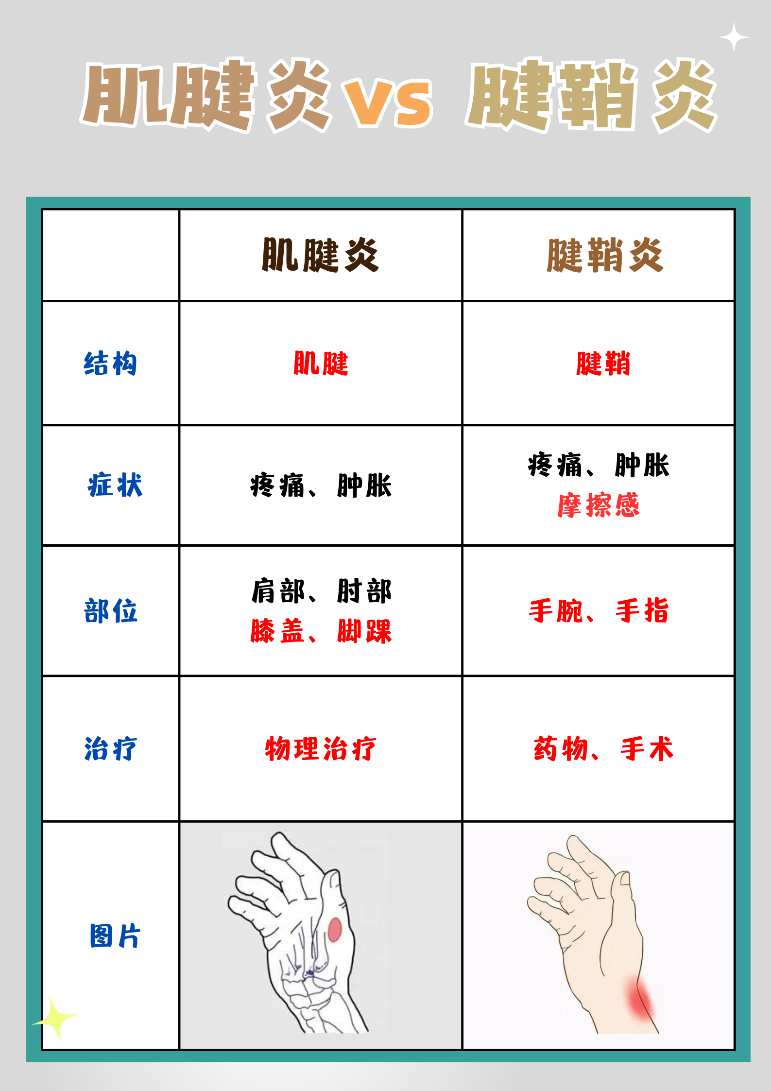 女同为什么会得腱鞘炎为什么在线