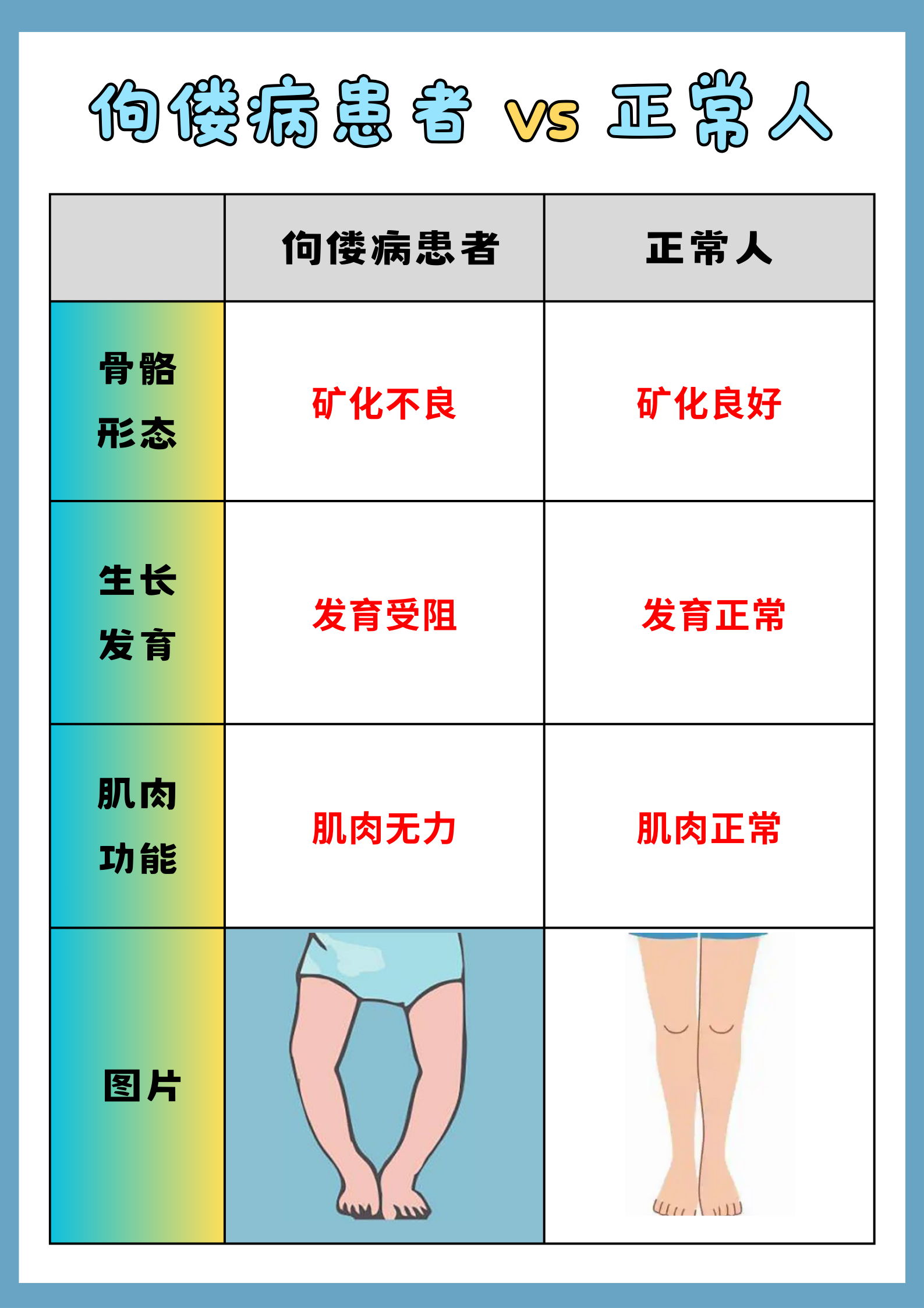 佝偻病患儿方颅图片