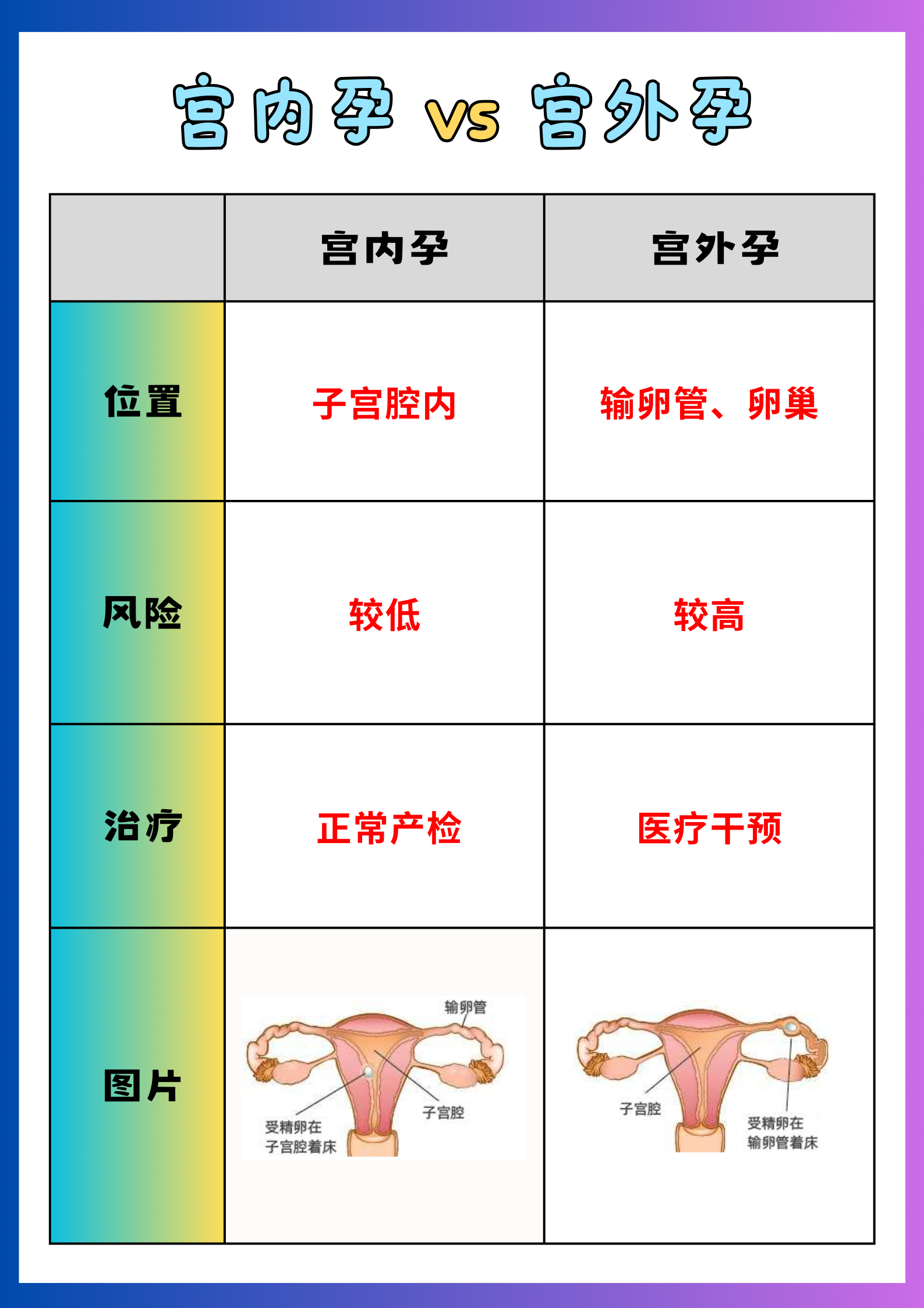 异位妊娠位置图片