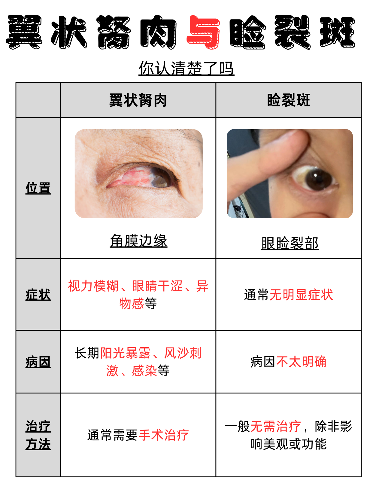 眼睑裂斑去除偏方图片