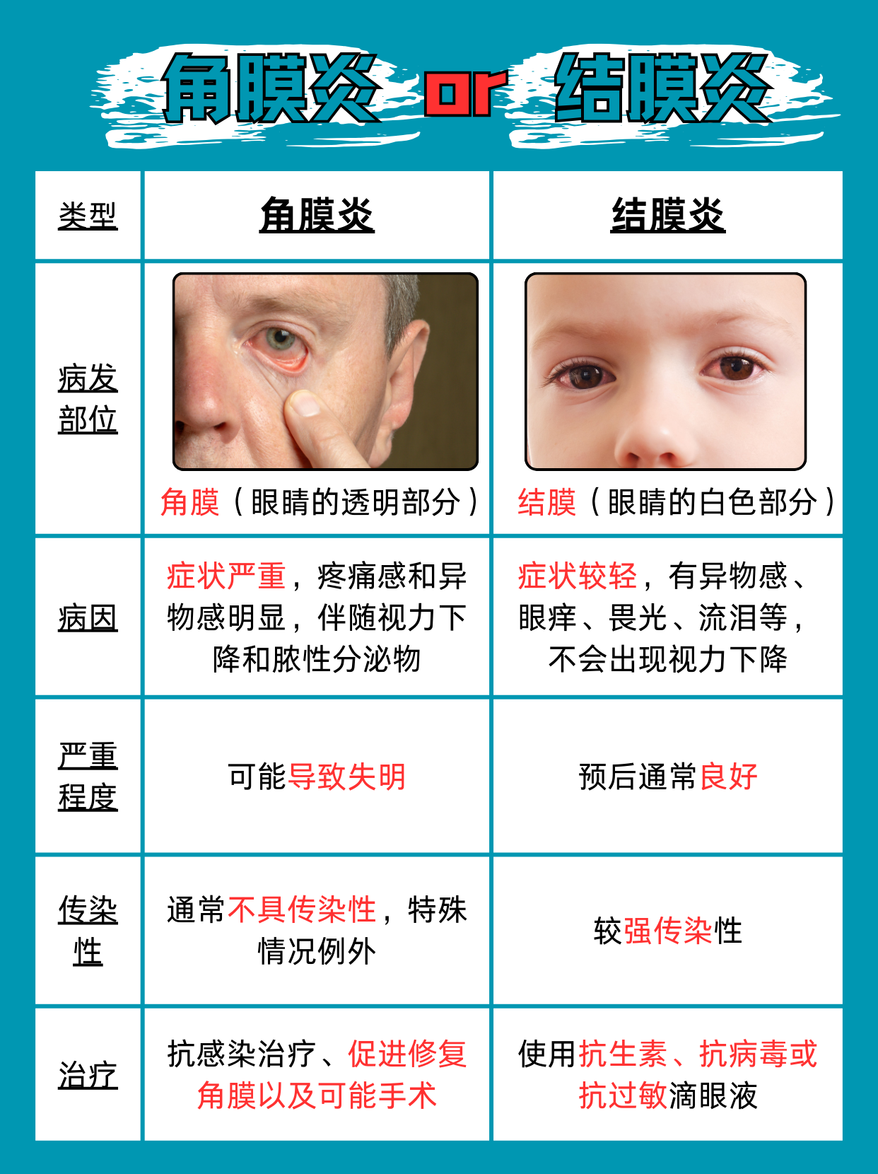 角膜炎和结膜炎的区别