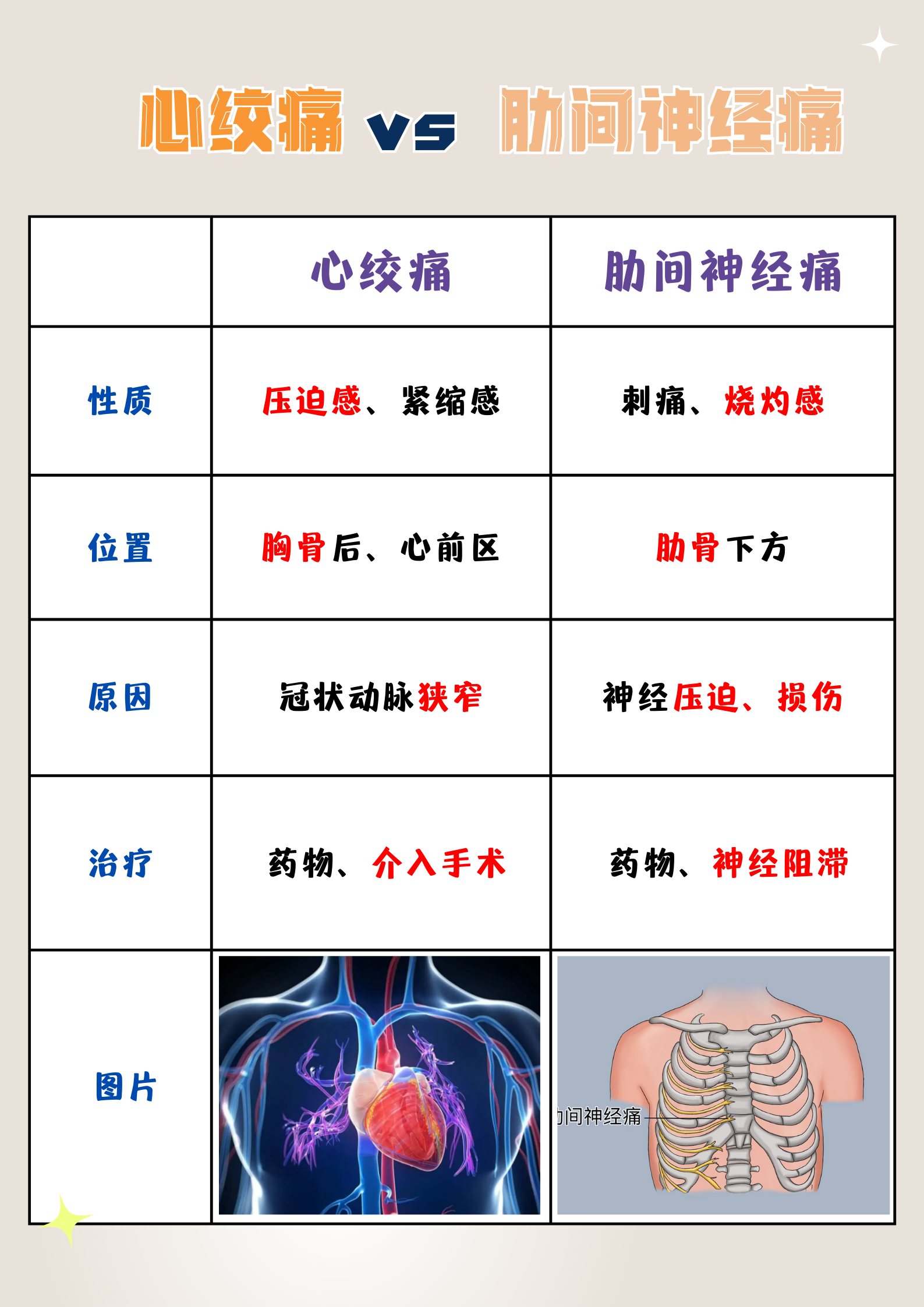 心绞痛 放射图片