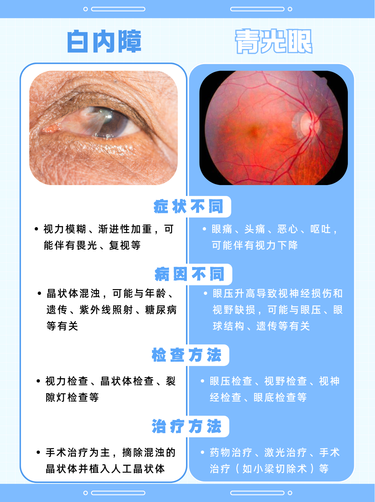 白内障和青光眼的区别